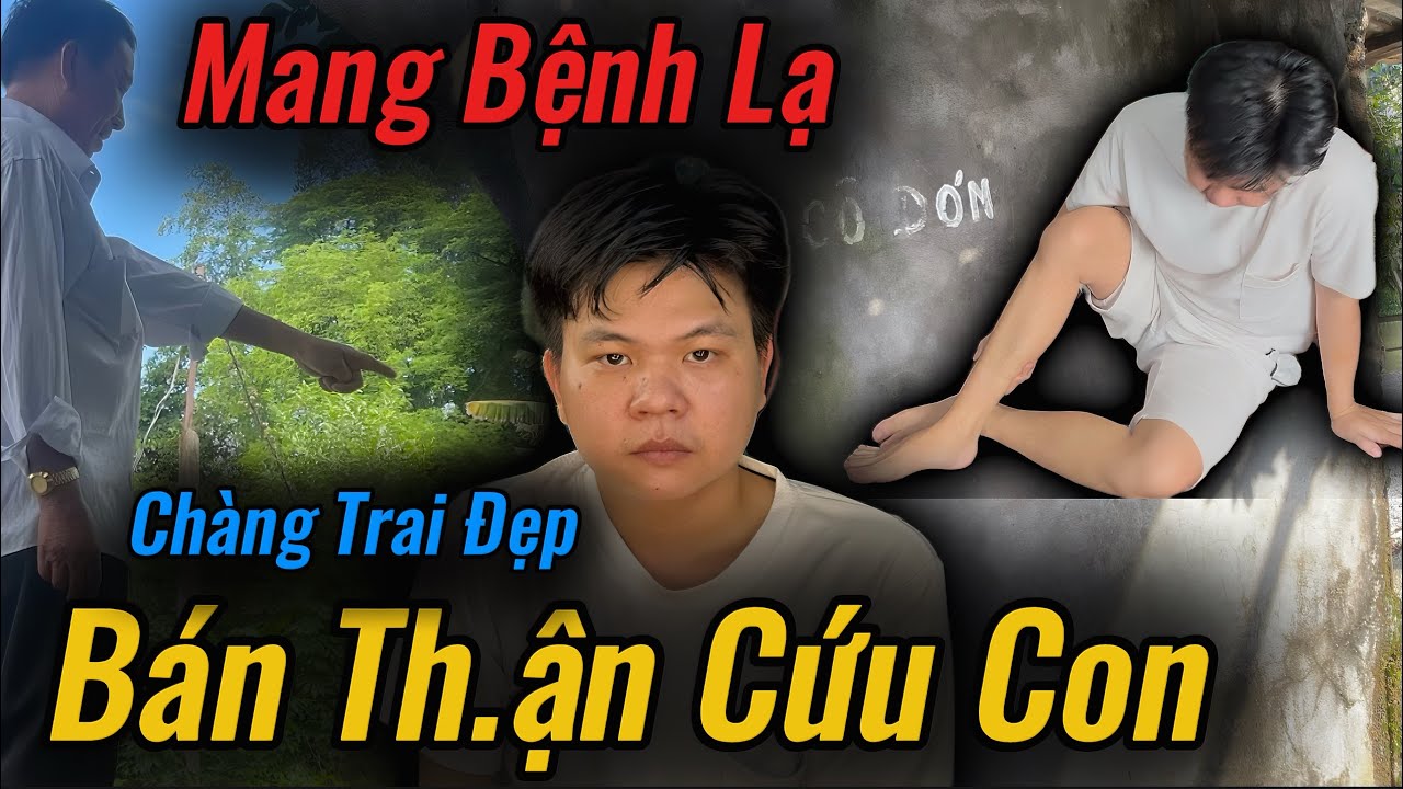 Phát Hiện, Chàng Trai Đẹp Mang B.ệnh Lạ Khiến Người Cha Làm Chuyện Này Gấp Chỉ Gì