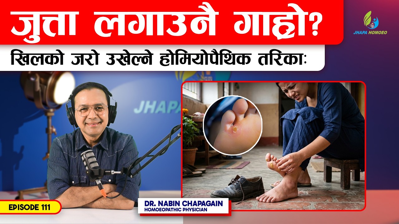 खिलको बिना अपरेसन रामबाण होमियोपैथिक दवाई | Episode - 111 | Dr. Nabin Chapagain