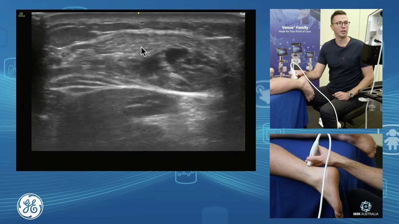 Venue Family | Achilles tendon assessment and injection