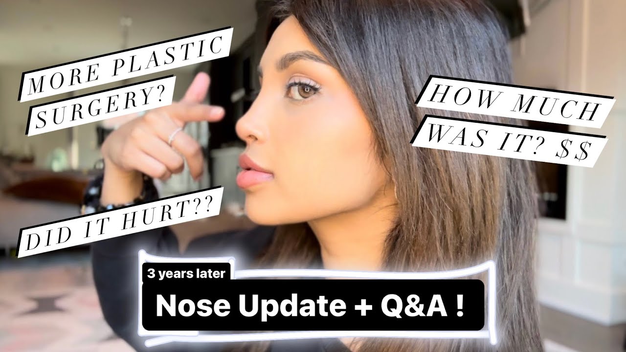 3 Year Nose Job (Rhinoplasty) Update + Q&A! - Famous Turkish Dr. Resit Burak Kayan
