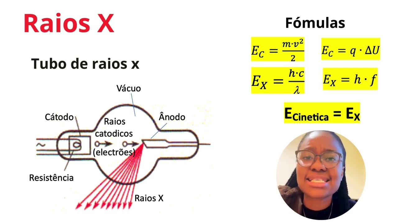 Aula 9 -  Raios X