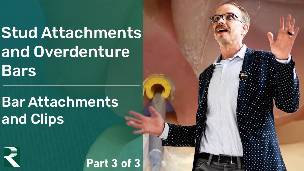 Stud Attachments and Overdenture Bars: Bar Attachments and Clips (Part 3)