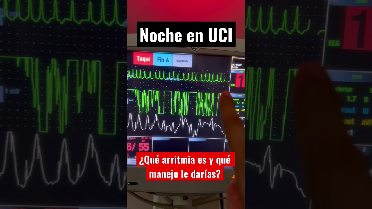 Trivia Nocturna #Arritmias #UCI
