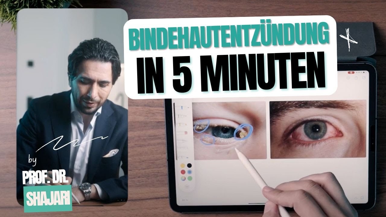 Die Bindehautentzündung Symptome, Behandlung einfach erklärt