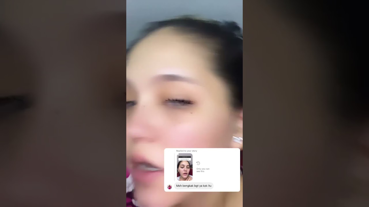 Setelah 3 Hari Piercing - Tindik Telinga