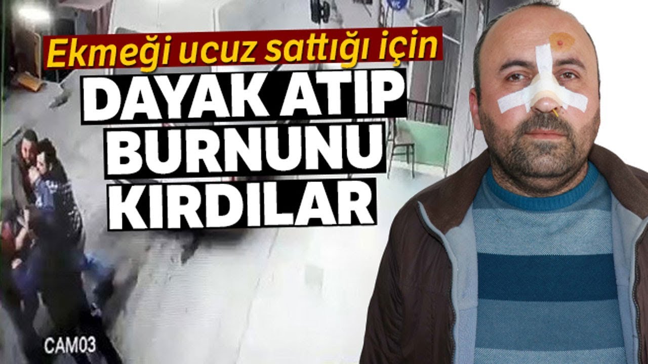 Ekmeği Ucuz Sattığı Gerekçesiyle Burnunu Kırdılar