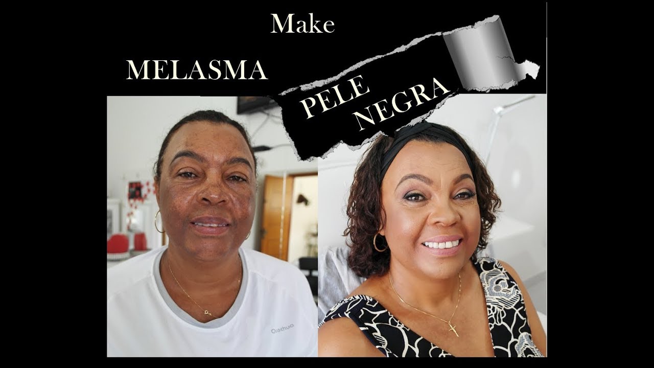 CAMUFLAGEM DE MELASMA EM PELE NEGRA!!!!!