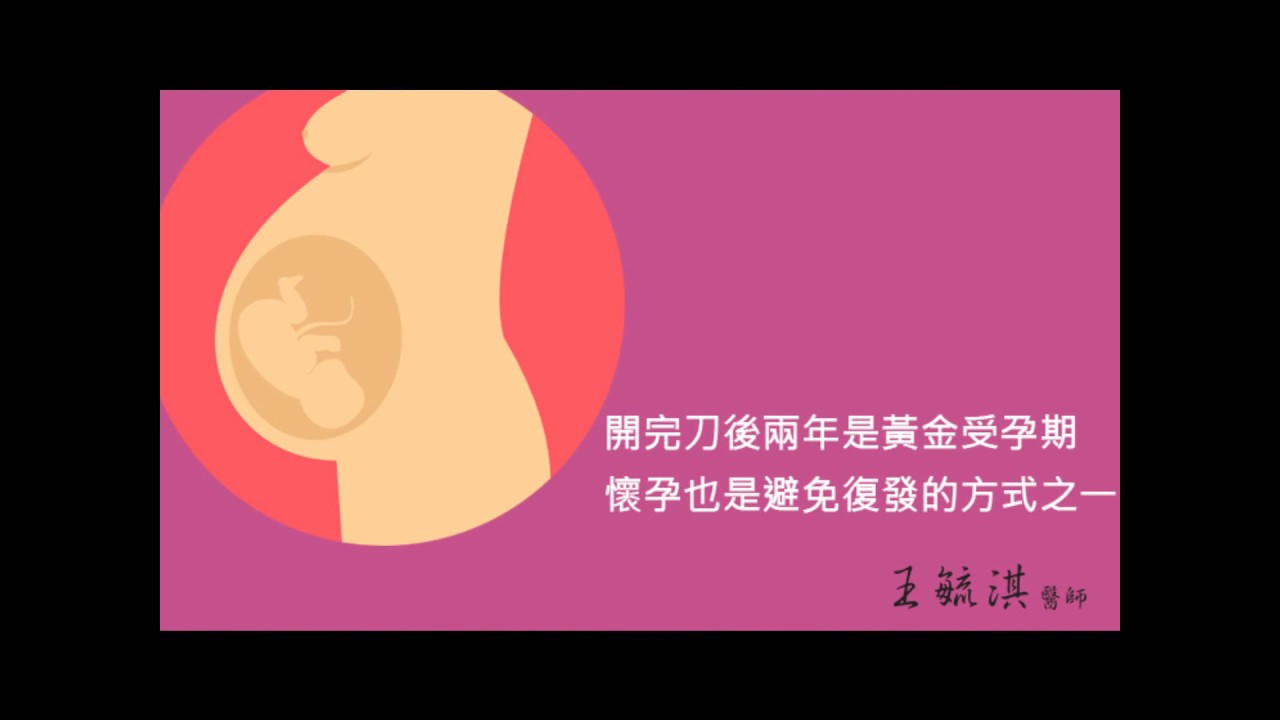 衛教影片- 巧克力囊腫淺談 王毓淇醫師