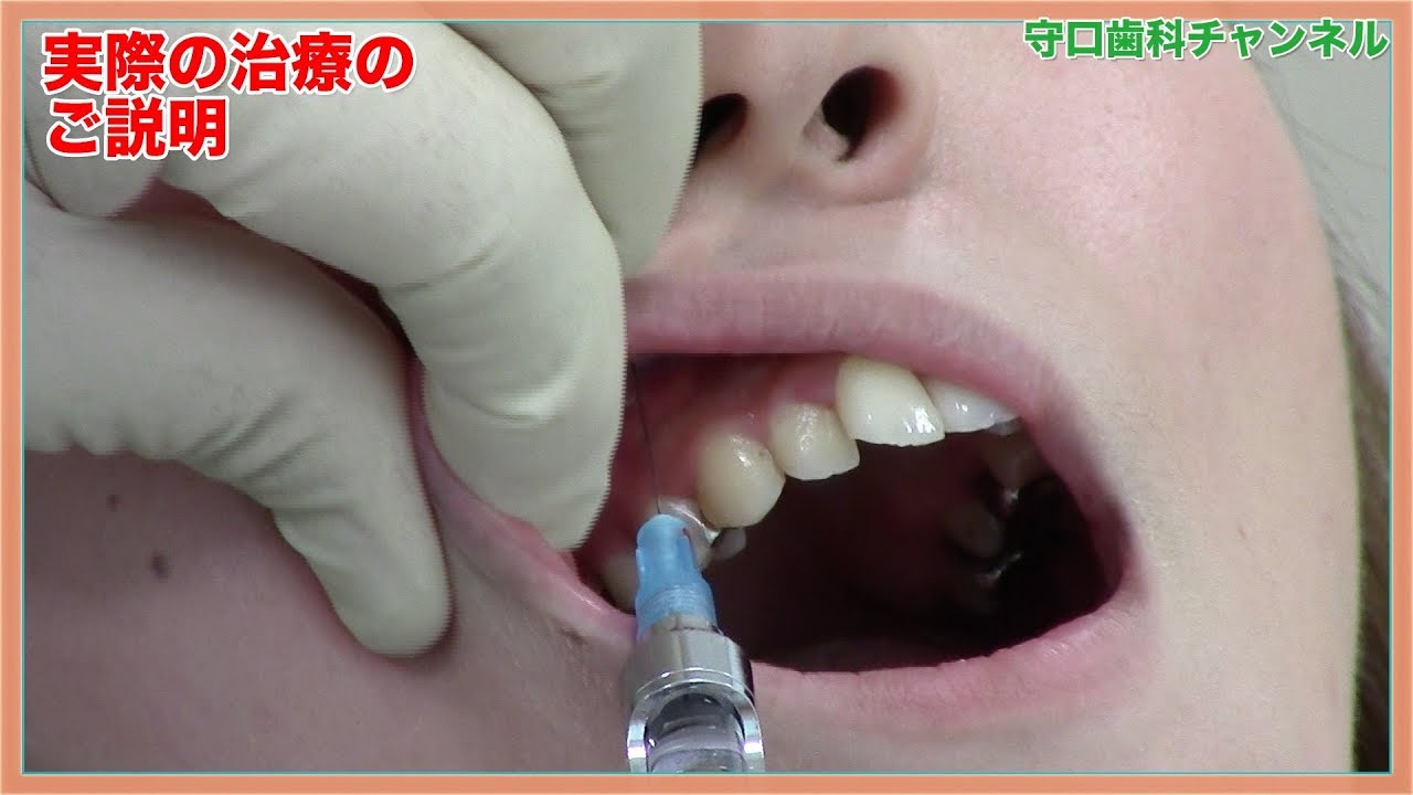【盛岡市 歯医者】できる？ 妊娠中の歯の治療_守口歯科チャンネル026（口腔ケアチャンネル）