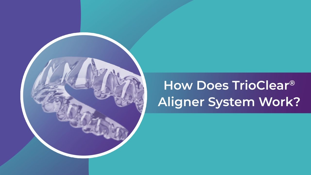TrioClear Aligners: Unlock the Power of Innovative Features for a Perfect Smile!