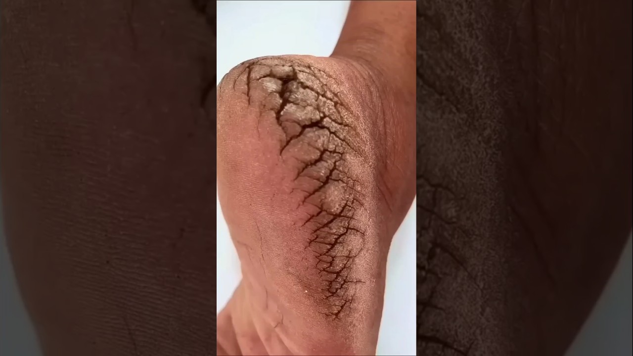 🔥Remove Feet Dirt& Tanning /Get Rid Of Cracked Heels & Feet😱/salon like pedicure at home#shorts#skin