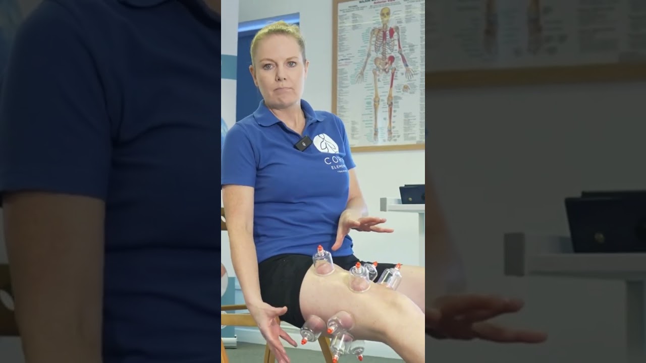 Functional Dry Cupping to the leg - 