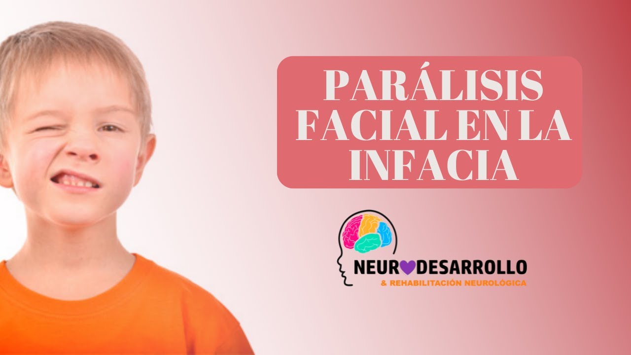 FACIAL PARALYSIS IN CHILDHOOD