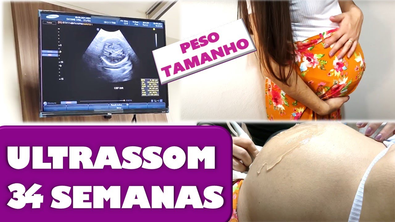 TAMANHO BEBE 34 SEMANAS - Ultrassom 34 semanas