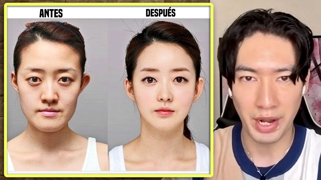 LA PLAGA DE CIRUGÍAS ESTÉTICAS EN COREA DEL SUR - Coreano y el motivo por el que se operan