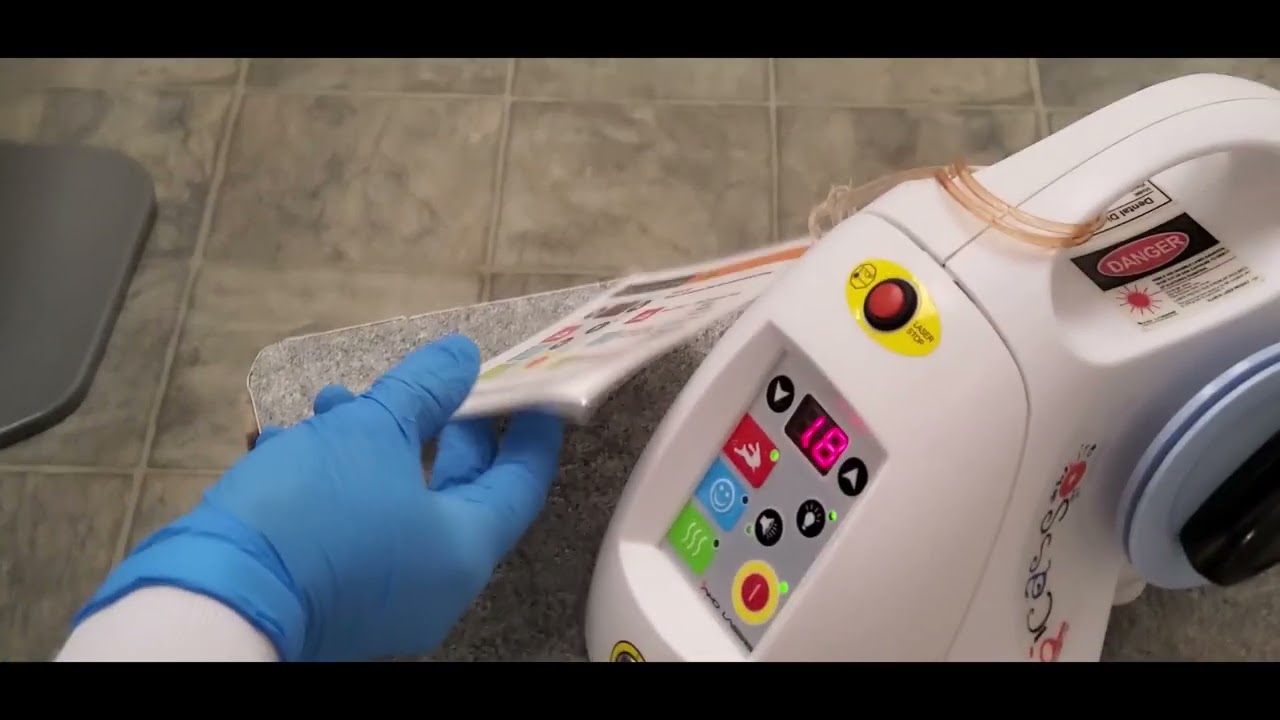 Laser Bacterial Reduction with Diode Laser