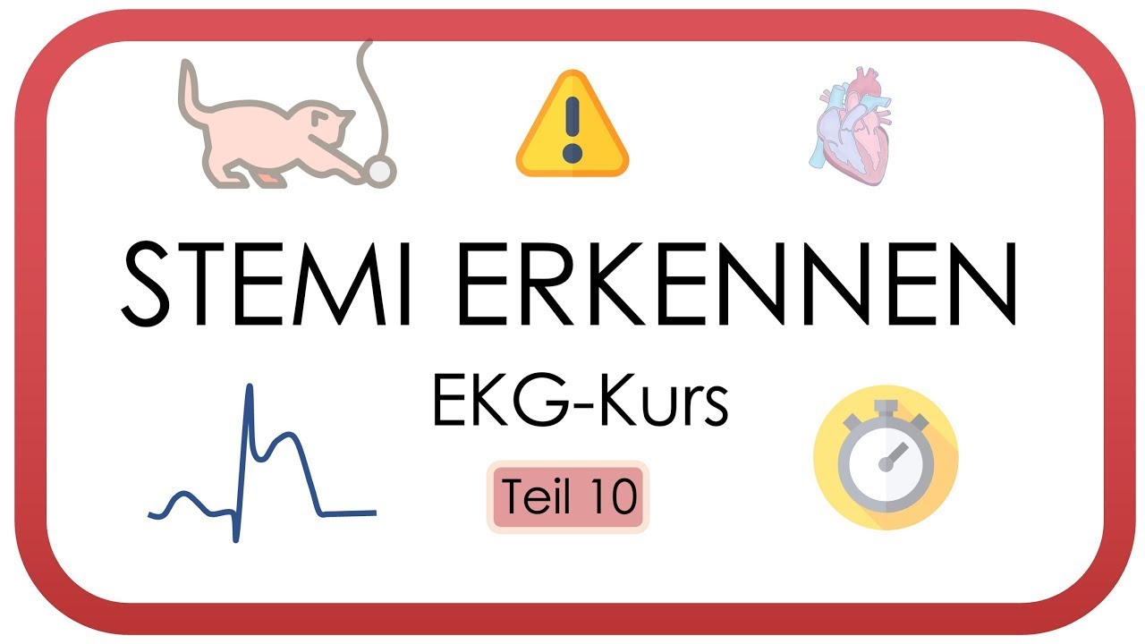STEMI im EKG erkennen (ST-Hebungsinfarkt, ST-Strecke, Stadien, Fallbeispiel) - EKG Kurs