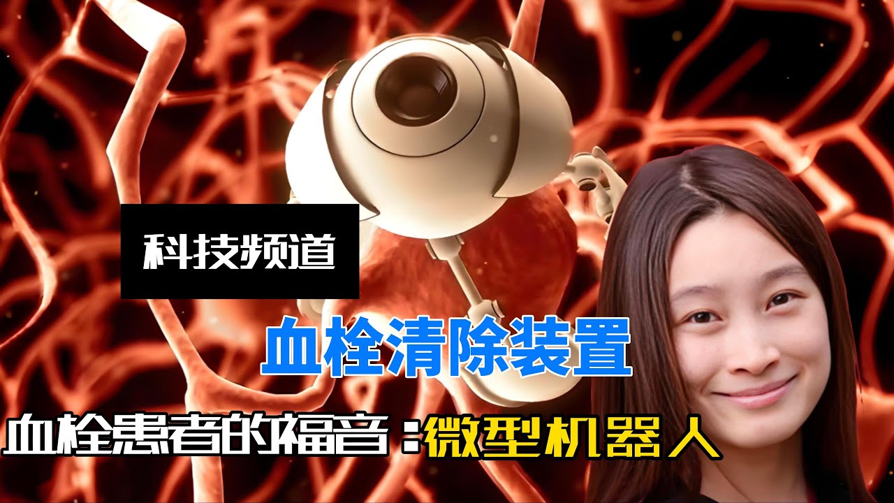 血栓清除微型盾构机清栓率95%，纳米清栓机器人14天自动降解零残留！#科技强国 #斯坦福赵芮可#清除血栓#纳米机器人