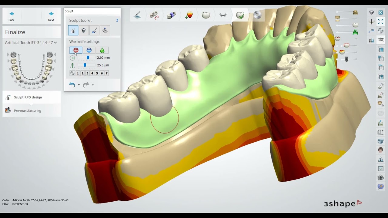 designing flexible partial denture with 3shape part2