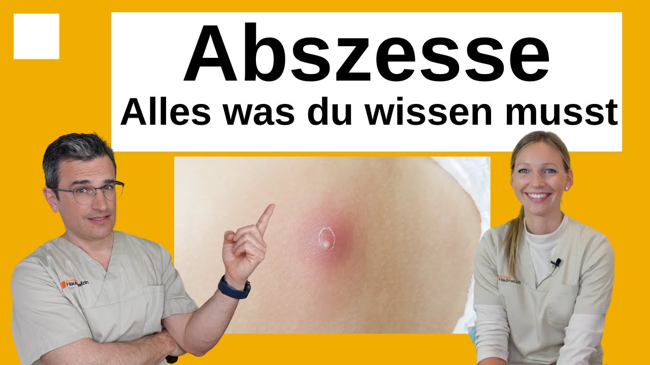 Abszeß - Ursachen, vermeiden, behandeln