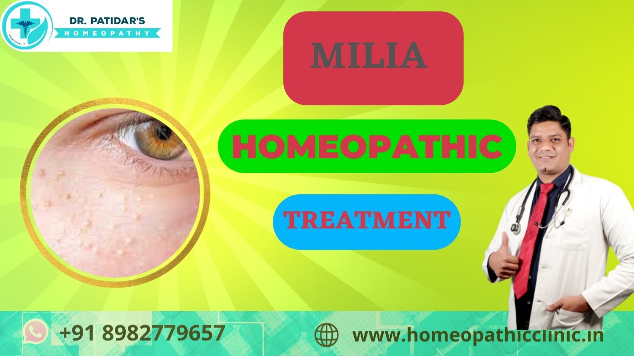Milia Homeopathy Medicine l Homeopathic medicine for syringoma