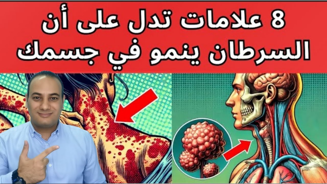 8 علامات مبكرة مؤكده للسرطان في جسمك وانت لا تعلم/ما هي اعراض السرطان التحذيرية المبكرة!!