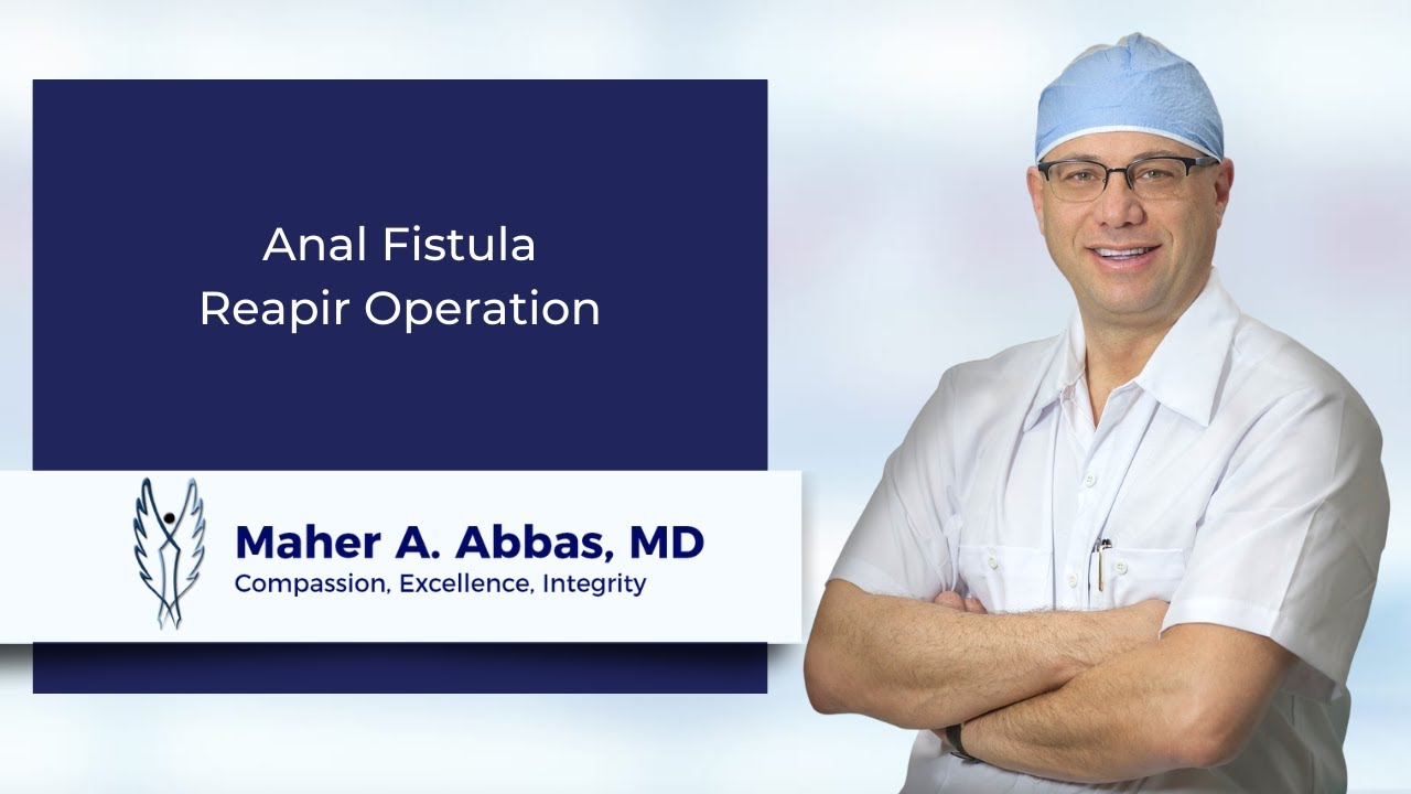 Best anal fistula repair operation by Dr Maher A. Abbas