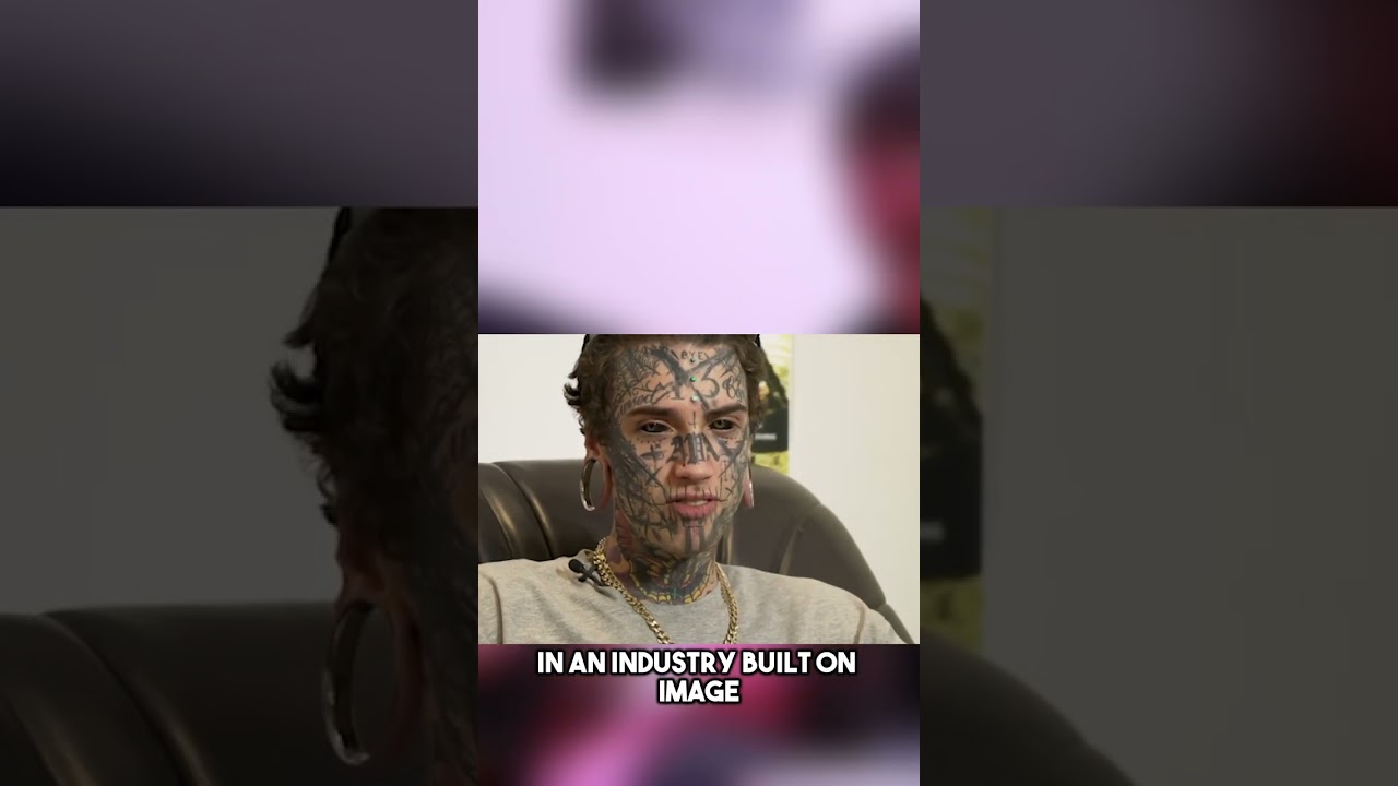 20 знаменитостей с самыми спорными результатами пластической хирургии 1