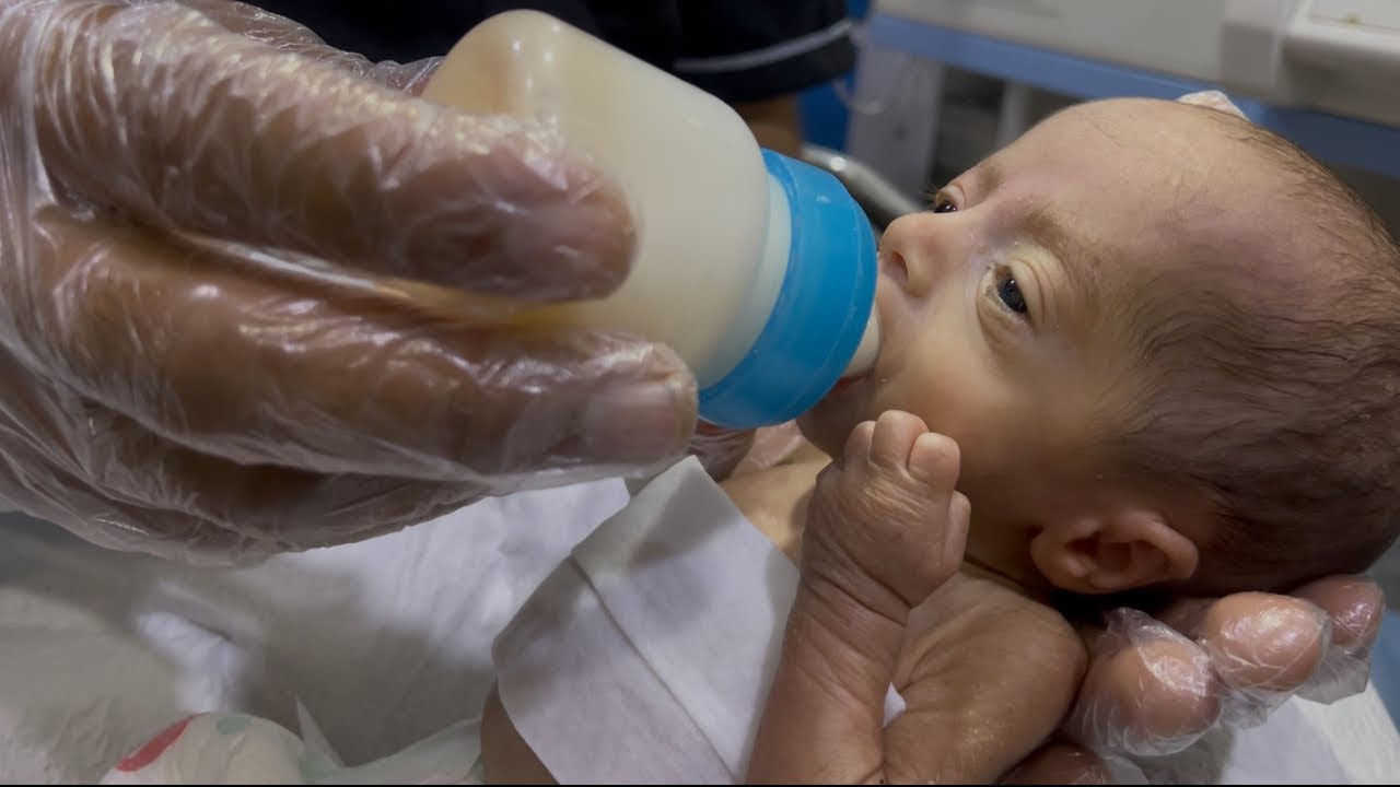 Day 3 – Adorable Premature Baby Recovered Mostly #PrematureBaby #BabyCare