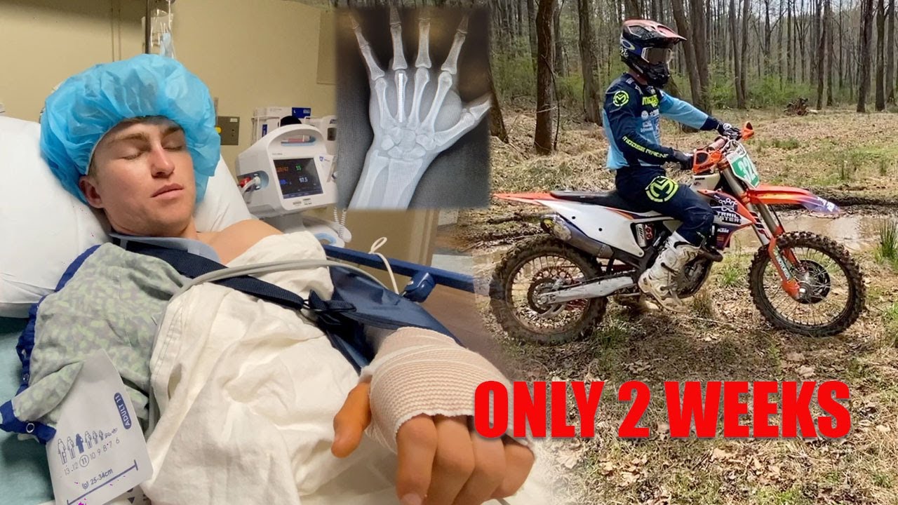 Broken Hand to Riding in 2 WEEKS - Jesse Ansley