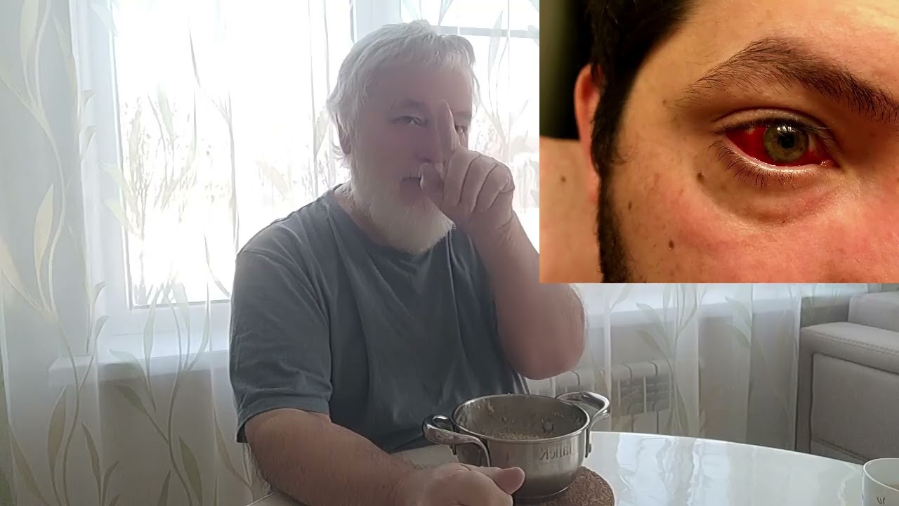 Что на самом деле с глазом Макрона