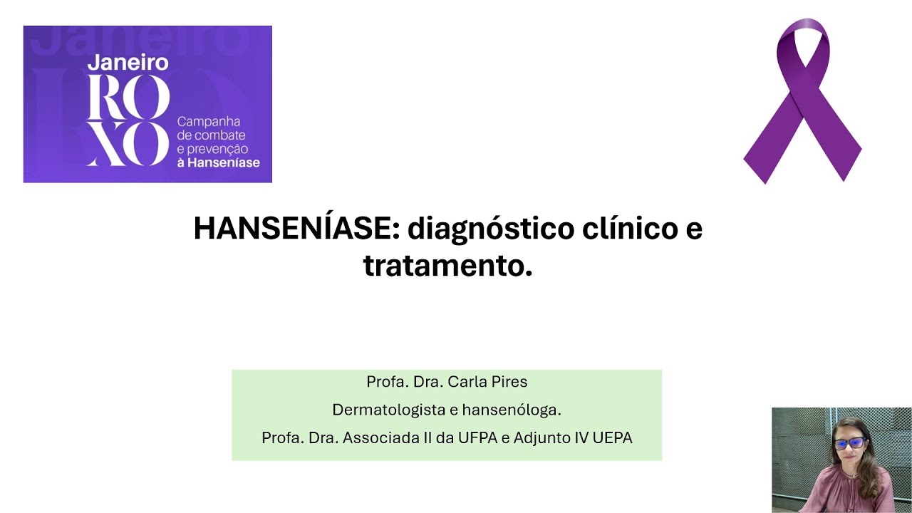 HANSENÍASE - Diagnóstico clínico e tratamento