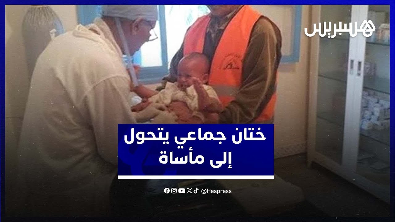 صادم.. تعفن خطير يهدد 5 أطفال بفقدان أجهزتهم التناسلية بعد استفادتهم من ختان جماعي بشفشاون