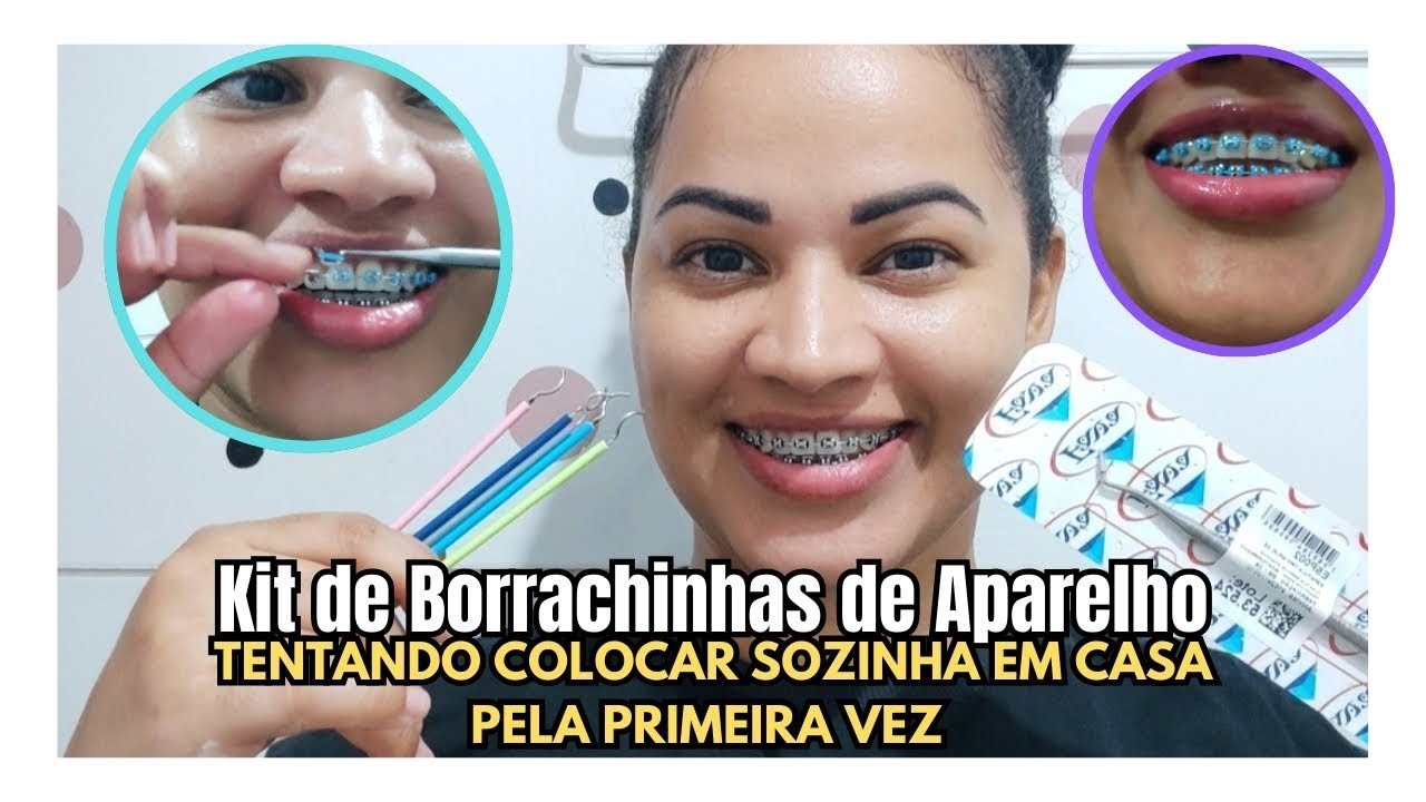 COMO TROCAR AS BORRACHINHAS DO APARELHO ORTODÔNTICO SOZINHA EM CASA/ kit completo