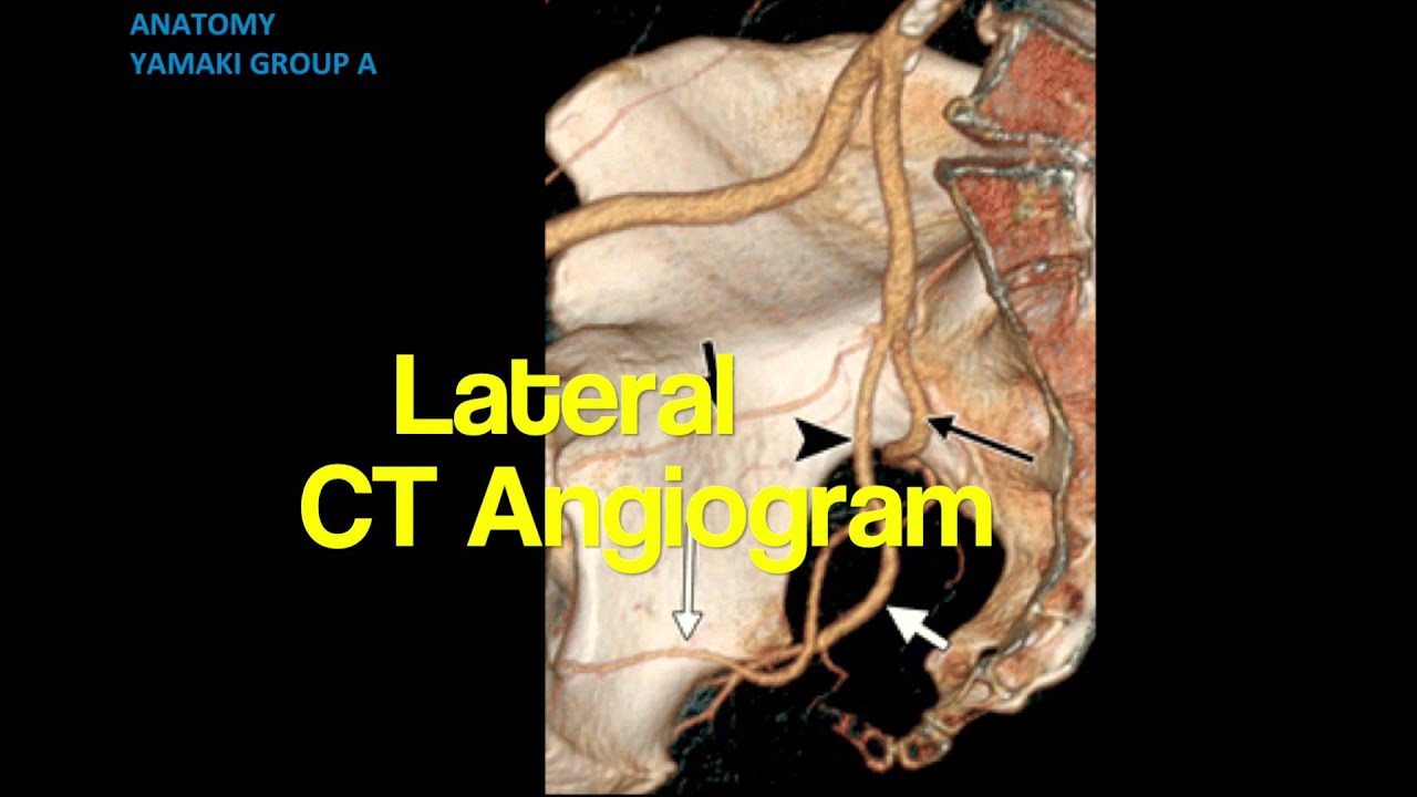 Internal Iliac Artery