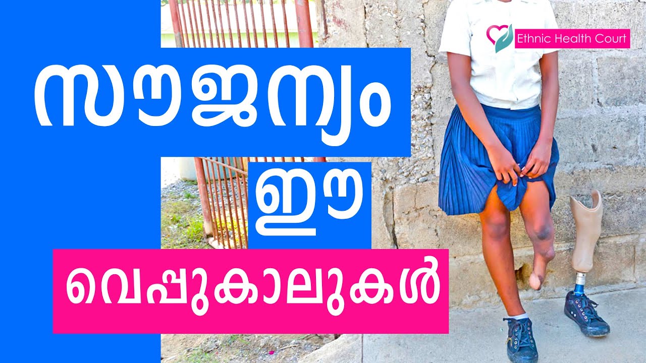സൗജന്യമായി വെപ്പുകാലുകൾ നിർമിച്ചു നൽകുന്നു | Free artifical limbs | Ethnic Health Court