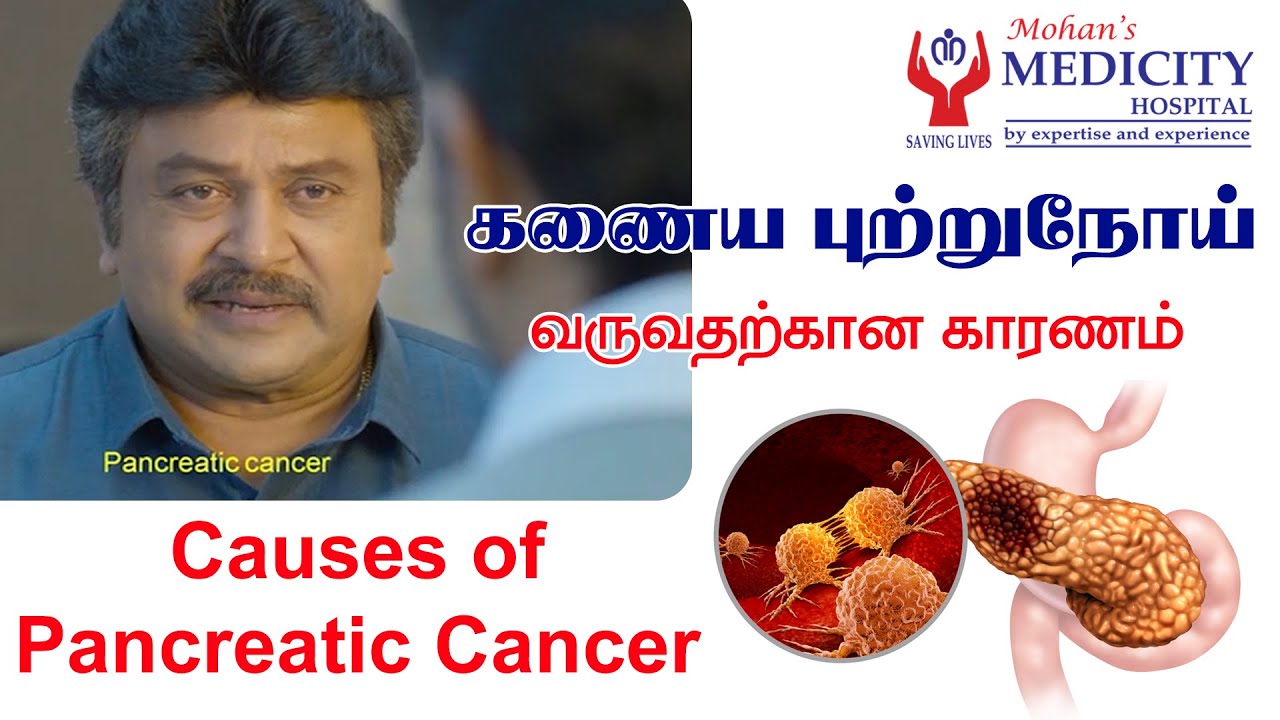Pancreatic cancer in Tamil | Varisu movie cancer | கணைய புற்றுநோய்| causes of pancreatic cancer
