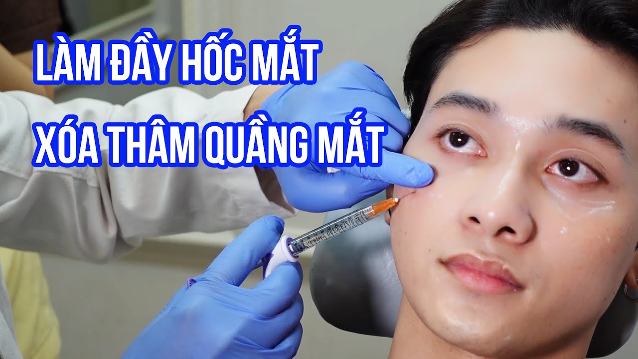 HƯỚNG DẪN TIÊM FILLER LÀM ĐẦY HỐC MẮT, XÓA THÂM QUẦNG MẮT CHO CA SĨ ROY NGUYỄN | BÁC SĨ KHẢI EVA