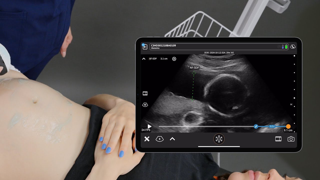 Amniotic Fluid Assessment