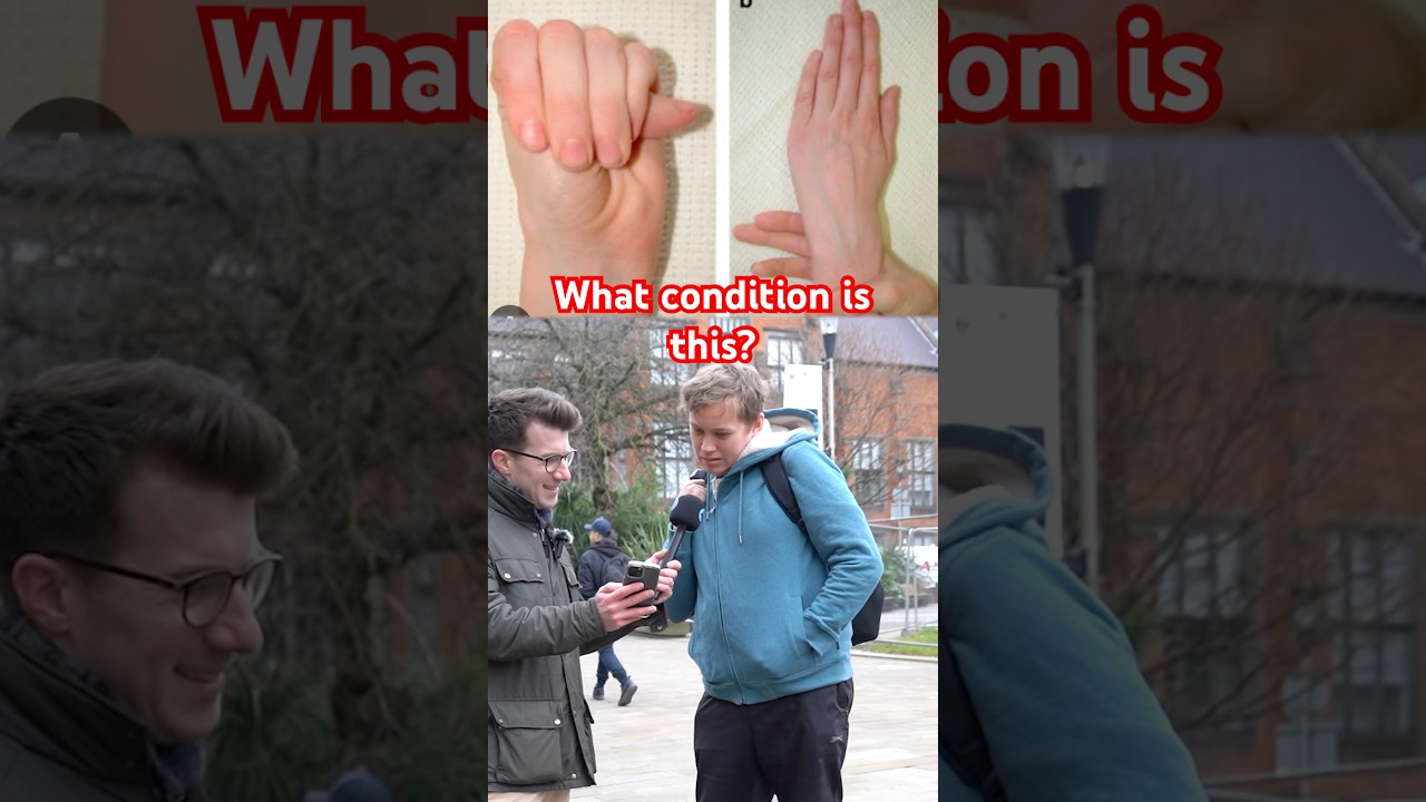 Doctor explains Marfan Syndrome #shorts