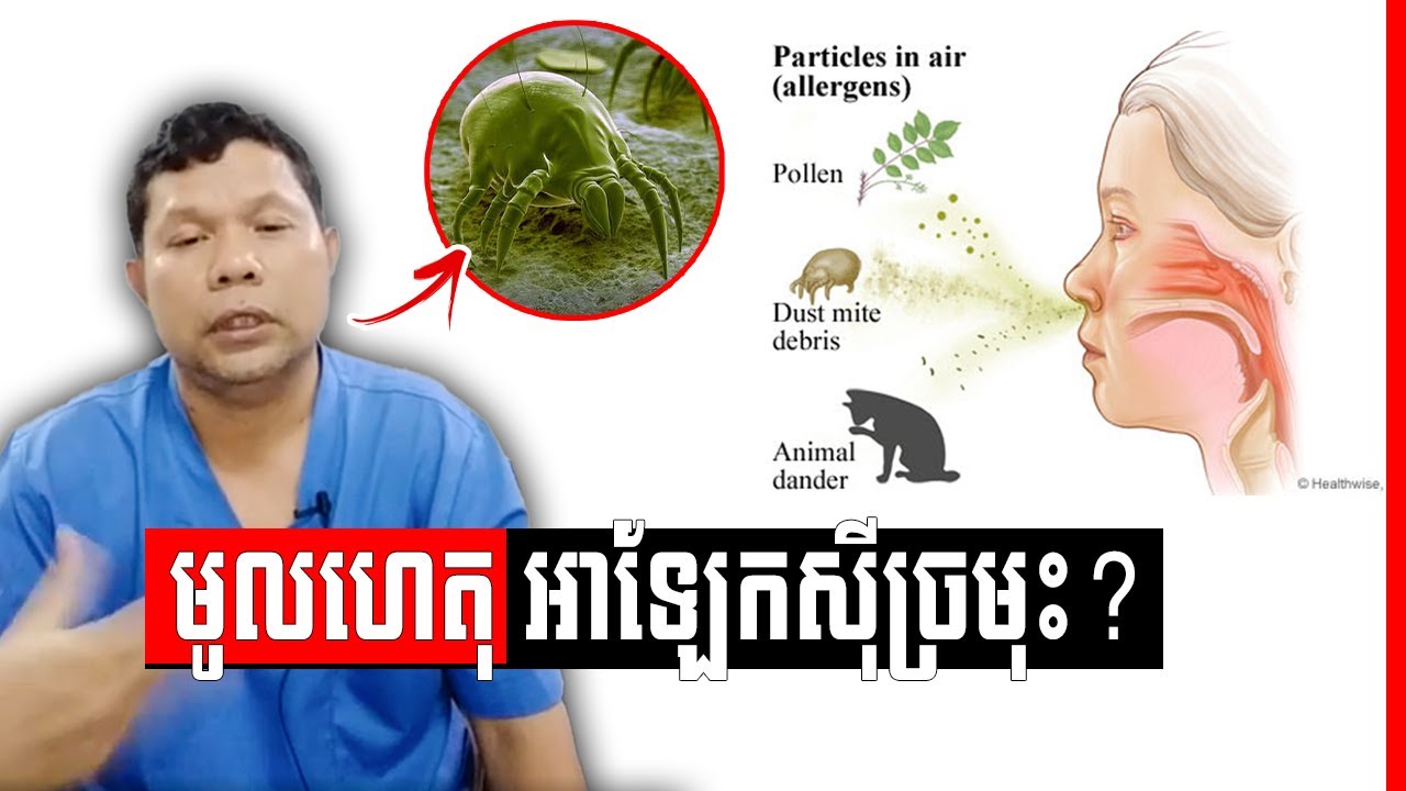 អាលែកស៊ីច្រមុះ ៖ មូលហេតុ​ ការព្យាបាល និង ការពារ​ វេជ្ជ. ហែន ភារៈ , Nose Allergic