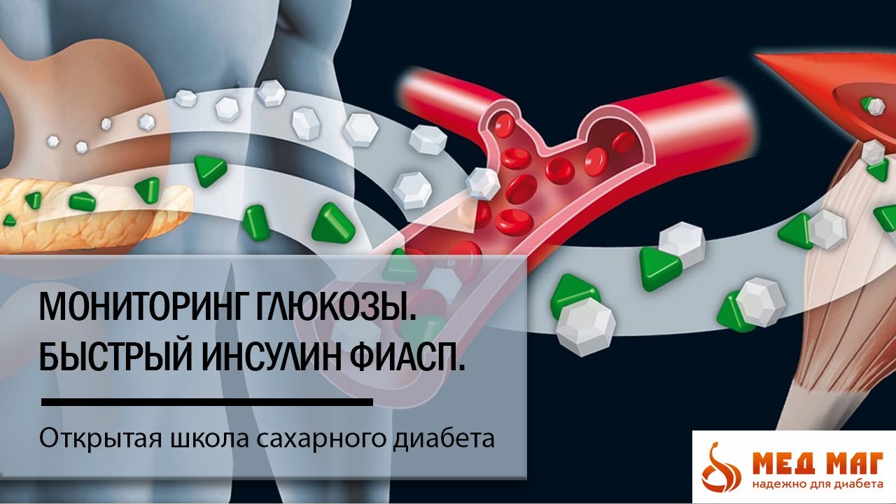 Мониторинг глюкозы Libre. Закрытый инсулиновый контур. Быстрый инсулин Фиасп.