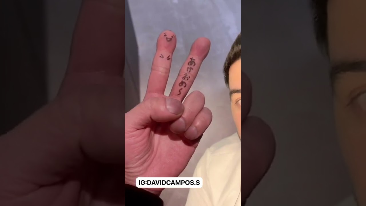 TIENE DEDOS EN FORMA DE PALILLOS DE TAMBOR / ACROPAQUIA