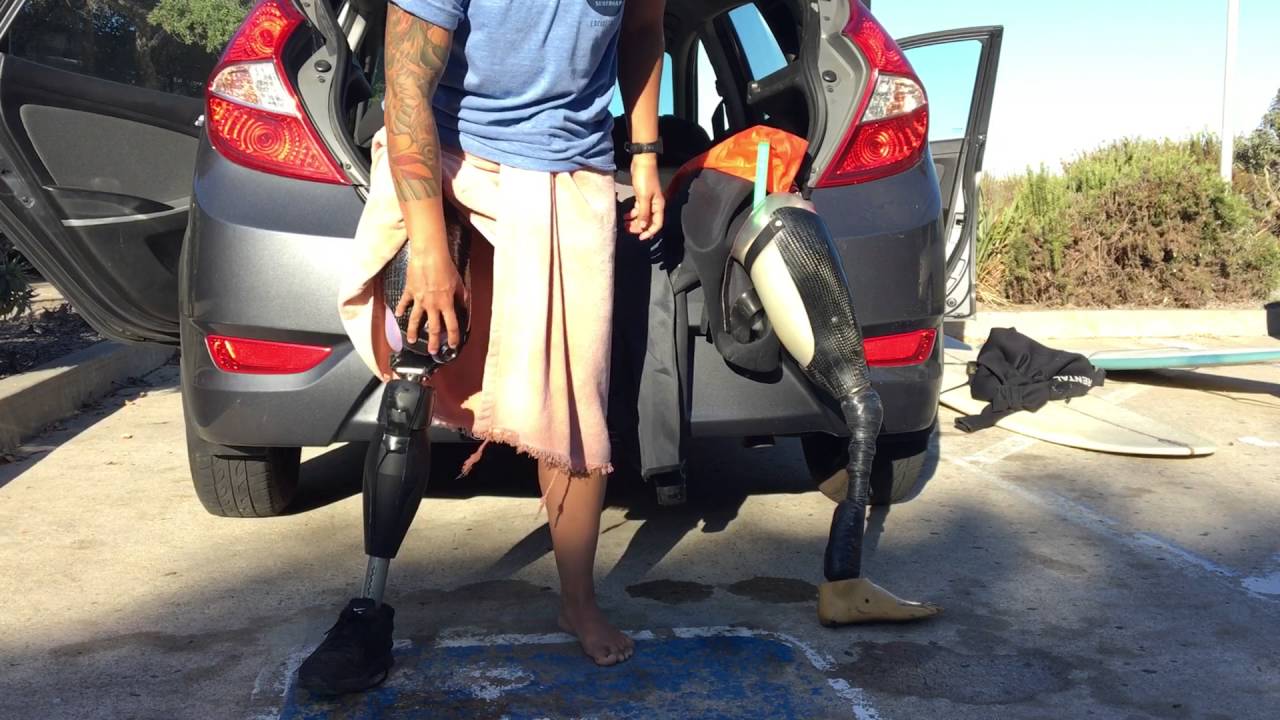 Above knee amputee tip: How to don a skin fit suction socket