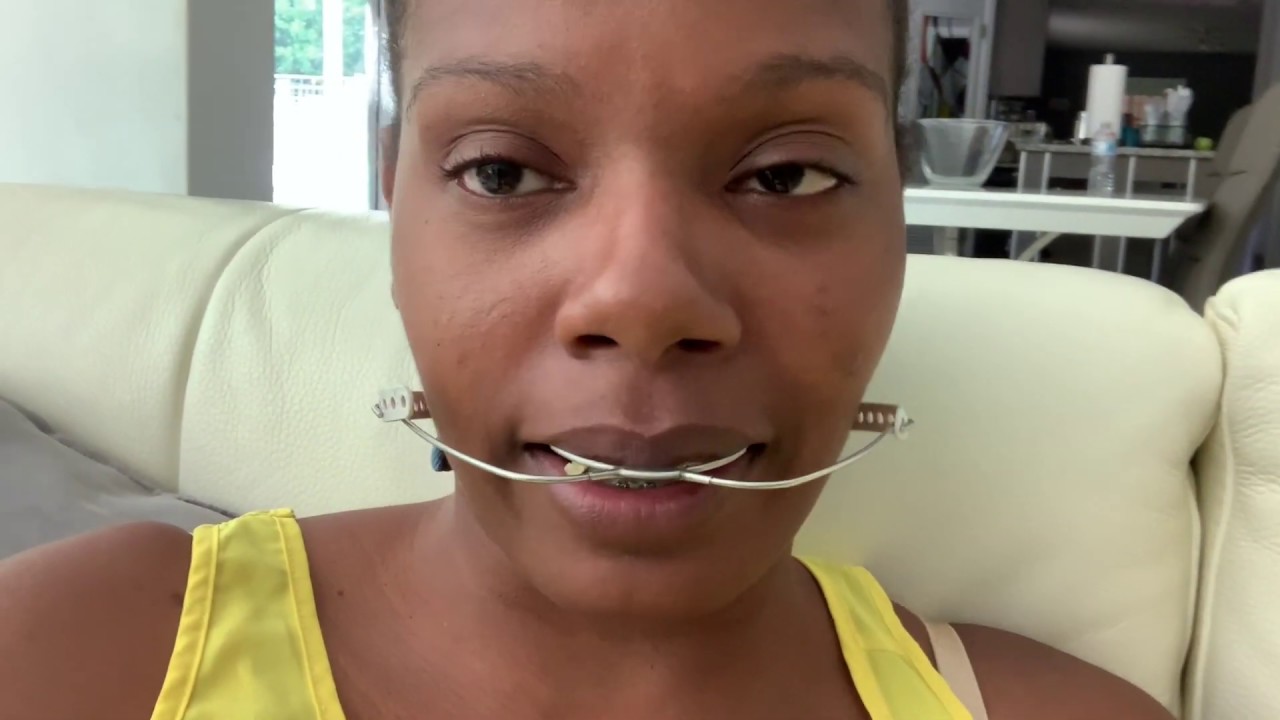 Braces Adjustment