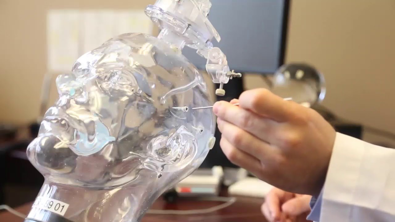 Deep brain stimulation offers relief to Parkinson's patient