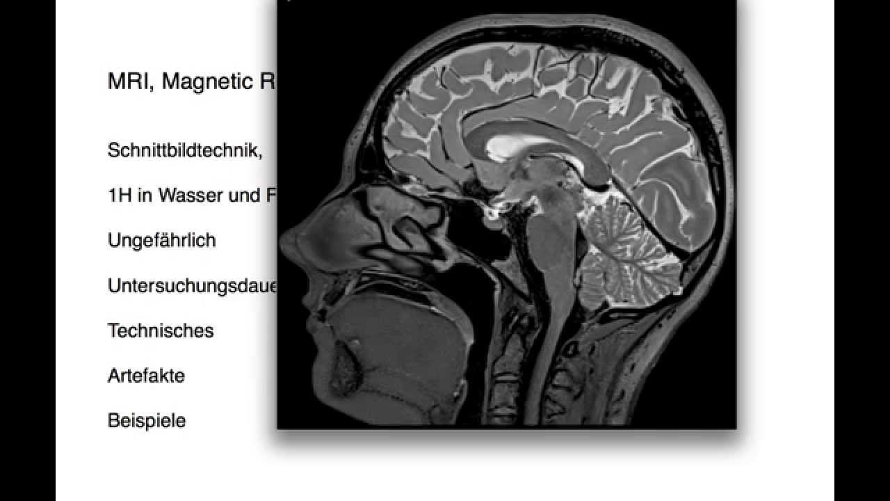 * MRI, Kernspintomographie