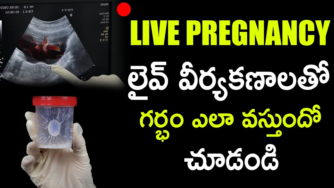 లైవ్ వీర్యకణాలతో గర్భం ఎలా వస్తుందో: IUI Pregnancy Process In Live | Dr Jyothi | Ferty9 Hospital
