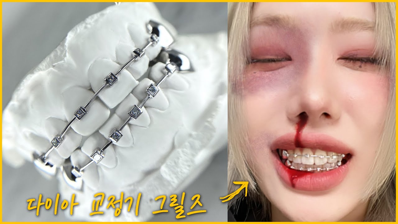 다이아 그릴즈 맞추고 왔어 🤐💎💎