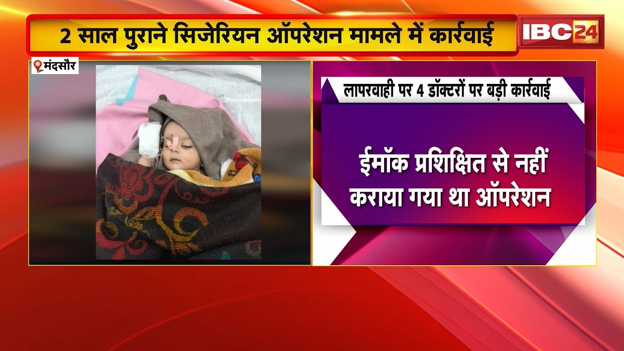 Mandsaur News: 2 साल पुराने सिजेरियन ऑपरेशन मामले में कार्रवाई।  4 वरिष्ठ डॉक्टरों पर हुई कार्रवाई